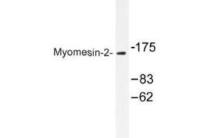 Image no. 1 for anti-Myomesin 2 (MYOM2) antibody (ABIN317920) (MYOM2 Antikörper)
