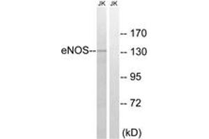 Western blot analysis of extracts from Jurkat cells, treated with Insulin 0. (ENOS Antikörper  (AA 1144-1193))