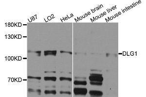 Western blot analysis of extracts of various cells, using DLG1 antibody. (DLG1 Antikörper)