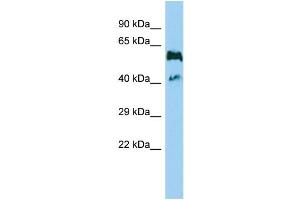 Host: Rabbit Target Name: GPR114 Sample Type: MDA-MB-435S Whole Cell lysates Antibody Dilution: 1.