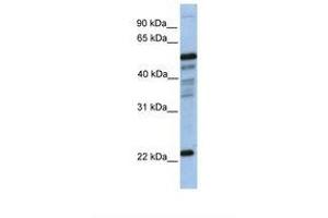 Image no. 1 for anti-Hematopoietic Prostaglandin D Synthase (HPGDS) (N-Term) antibody (ABIN6738498) (HPGDS Antikörper  (N-Term))