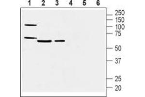 Western blot analysis of mouse heart membranes (lanes 1 and 4), mouse lung lysate (lanes 2 and 5) and rat lung membranes (lanes 3 and 6): - 1-3. (Prostacyclin Receptor Antikörper  (3rd Extracellular Loop))