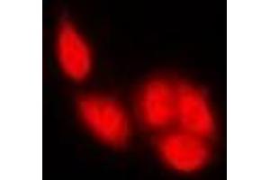 Immunofluorescent analysis of NFAT2 staining in U2OS cells.