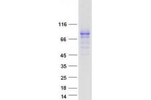 Validation with Western Blot