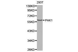 Western Blotting (WB) image for anti-P21-Activated Kinase 1 (PAK1) antibody (ABIN1874026) (PAK1 Antikörper)