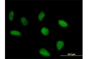Immunofluorescence of purified MaxPab antibody to FLJ10379 on HeLa cell. (SRBD1 Antikörper  (AA 1-620))