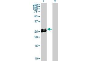 Western Blot analysis of EPDR1 expression in transfected 293T cell line by EPDR1 MaxPab polyclonal antibody.