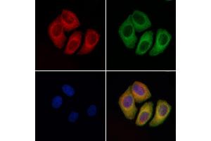 ABIN6264731 and ABIN6276568 staining Hela cells by IF/ICC. (RHEB Antikörper  (Internal Region))