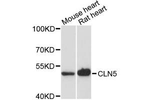Western blot analysis of extracts of various cell lines, using CLN5 antibody. (CLN5 Antikörper)