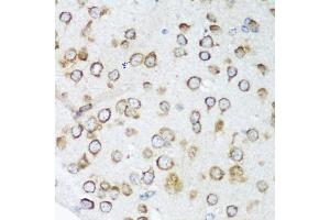Immunohistochemistry of paraffin-embedded mouse brain using NOTCH2 antibody. (NOTCH2 Antikörper)