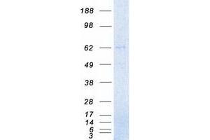 Western Blotting (WB) image for Interleukin-1 Receptor-Associated Kinase 3 (IRAK3) (Transcript Variant 1) protein (Myc-DYKDDDDK Tag) (ABIN2723783)