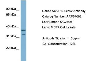 WB Suggested Anti-RALGPS2  Antibody Titration: 0. (RALGPS2 Antikörper  (C-Term))