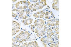 Immunohistochemistry of paraffin-embedded human stomach using TNFRSF10A antibody. (TNFRSF10A Antikörper  (AA 269-468))