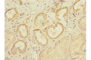 Immunohistochemistry of paraffin-embedded human kidney tissue using ABIN7170032 at dilution of 1:100 (SLC28A1 Antikörper  (AA 1-80))