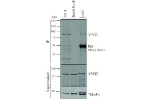 Immunoprecipitation analysis using Mouse Anti-VPS35 Monoclonal Antibody, Clone 10A8 (ABIN6932992). (VPS35 Antikörper  (Biotin))