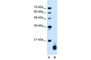 Image no. 2 for anti-Cyclophilin B (PPIB) (C-Term) antibody (ABIN205044) (PPIB Antikörper  (C-Term))