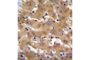 Immunohistochemistry analysis in formalin fixed and paraffin embedded human liver tissue reacted with PHF12 Antibody (C-term) followed which was peroxidase conjugated to the secondary antibody and followed by DAB staining. (PHF12 Antikörper  (C-Term))