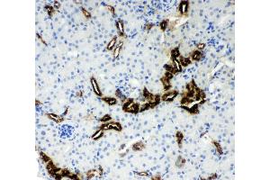 Anti-Kallikrein 1 antibody, IHC(P) IHC(P): Mouse Kidney Tissue (Kallikrein 1 Antikörper  (AA 25-261))