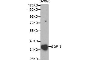 Western blot analysis of SW620 cell lysate using GDF15 antibody. (GDF15 Antikörper  (AA 49-308))