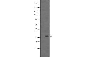 Western blot analysis of FGF12 expression in Mouse brain lysate ,The lane on the left is treated with the antigen-specific peptide. (FGF12 Antikörper  (C-Term))