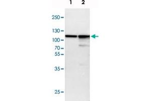 Western blot analysis of Lane 1: NIH-3T3 cell lysate (Mouse embryonic fibroblast cells), Lane 2: NBT-II cell lysate (Rat Wistar bladder tumour cells) with ACTN4 polyclonal antibody  at 1:100-1:500 dilution. (alpha Actinin 4 Antikörper)