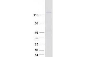 Western Blotting (WB) image for Integrin, alpha E (Antigen CD103, Human Mucosal Lymphocyte Antigen 1, alpha Polypeptide) (ITGAE) protein (Myc-DYKDDDDK Tag) (ABIN2713355)
