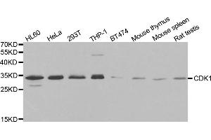 Western blot analysis of extracts of various cell lines, using CDK1 antibody (ABIN5970051) at 1/1000 dilution. (CDK1 Antikörper  (Center))
