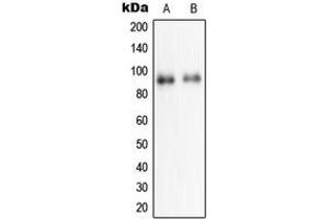 Western blot analysis of NPAS2 expression in HeLa (A), HepG2 (B) whole cell lysates. (NPAS2 Antikörper  (Center))