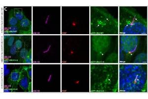 Representative images of immunostaining of ARL13B (cat. (ARL13B Antikörper  (C-Term))