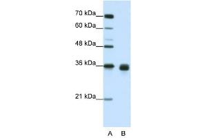 WNT2B antibody used at 1. (WNT2B Antikörper  (Middle Region))