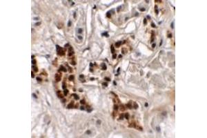 Immunohistochemistry (IHC) image for anti-SPRY Domain Containing 4 (SPRYD4) (Middle Region) antibody (ABIN1031106) (SPRYD4 Antikörper  (Middle Region))