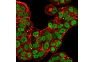 Immunofluorescence Analysis of PFA-fixed MCF-7 cells labeled with FOXA1 Rabbit Recombinant Monoclonal Antibody (FOXA1/2230R), followed by goat anti- rabbit IgG- CF488. (Rekombinanter FOXA1 Antikörper  (AA 372-472))