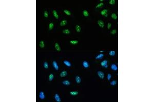 Immunofluorescence analysis of U-2 OS cells using DHX9/RNA Helicase Aantibody (ABIN7265748) at dilution of 1:100. (DHX9 Antikörper)