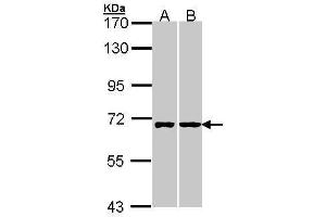 WB Image Sample (30 ug of whole cell lysate) A: A431 , B: Hela 7. (RIC8A Antikörper  (C-Term))
