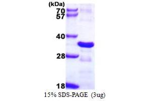 SDS-PAGE (SDS) image for Charged Multivesicular Body Protein 2B (CHMP2B) (AA 1-213) protein (His tag) (ABIN667925) (CHMP2B Protein (AA 1-213) (His tag))