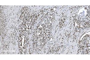 IHC analysis of SAMHD1 using anti-SAMHD1 antibody (ABIN7601514). (SAMHD1 Antikörper  (AA 37-626))
