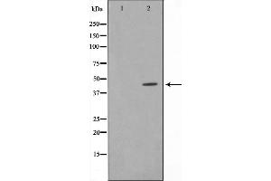 Western blot analysis on HeLa cell lysate using IRF4 Antibody，The lane on the left is treated with the antigen-specific peptide. (IRF4 Antikörper  (C-Term))