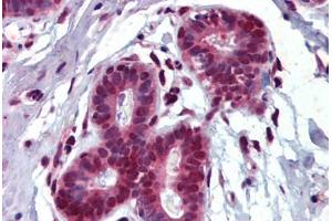 Breast, Human: Formalin-Fixed, Paraffin-Embedded (FFPE) (THRSP Antikörper)