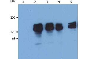 Western Blotting analysis (reducing conditions) of human SHIP-1 in whole cell lysate of THP-1 human acute monocytic leukemia cell line. (INPP5D Antikörper  (N-Term))