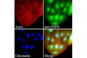 Immunofluorescenitrocellulosee of HaCaT cells stained with Hoechst 3342 (Blue) or phalloidin-TRITC for nucleus or actin staining, respectably.