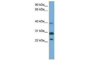 CCDC28A antibody used at 0. (CCDC28A Antikörper  (Middle Region))