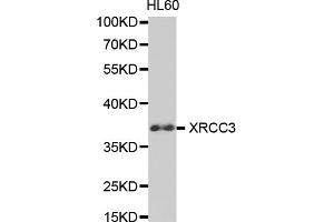 Western blot analysis of extracts of HL-60 cells, using XRCC3 antibody (ABIN5971161) at 1/1000 dilution.