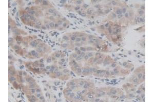 Used in DAB staining on fromalin fixed paraffin- embedded kidney tissue (FAM132A Antikörper  (AA 92-241))