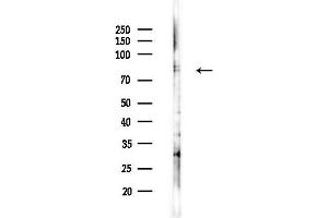 anti-Metastasis Associated 1 (MTA1) (Internal Region) antibody