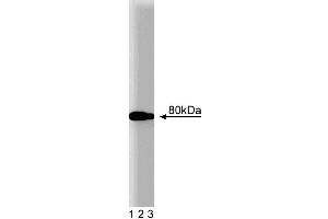Western blot analysis of BMX on Jurkat lysate. (BMX Antikörper  (AA 138-276))
