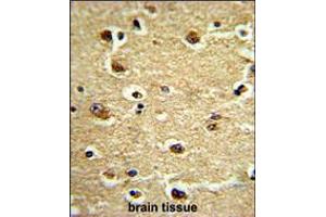 Formalin-fixed and paraffin-embedded human brain tissue reacted with CROT Antibody (N-term), which was peroxidase-conjugated to the secondary antibody, followed by DAB staining. (CROT Antikörper  (N-Term))