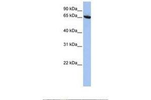 Image no. 1 for anti-Core-binding Factor, Runt Domain, alpha Subunit 2, Translocated To, 2 (CBFA2T2) (N-Term) antibody (ABIN6737842)
