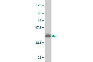 Western Blot detection against Immunogen (36. (COQ8A Antikörper  (AA 1-100))