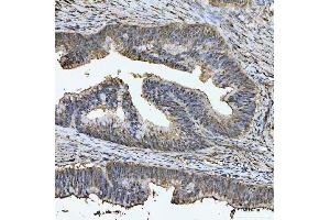 IHC analysis of TIGD1 using anti-TIGD1 antibody (ABIN7602407). (TIGD1 Antikörper  (AA 74-591))
