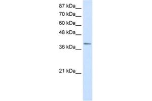 Western Blotting (WB) image for anti-LIM Homeobox Transcription Factor 1, alpha (LMX1A) antibody (ABIN2460347) (LMX1A Antikörper)